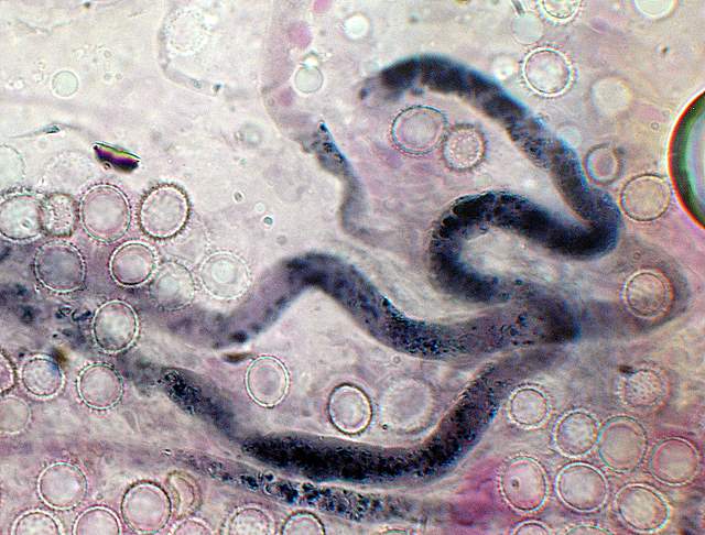 La  Flora  micologica  Alsaziana